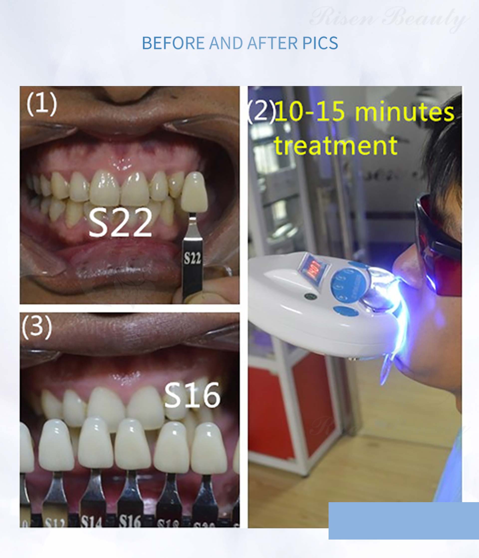 machine de blanchiment des dents